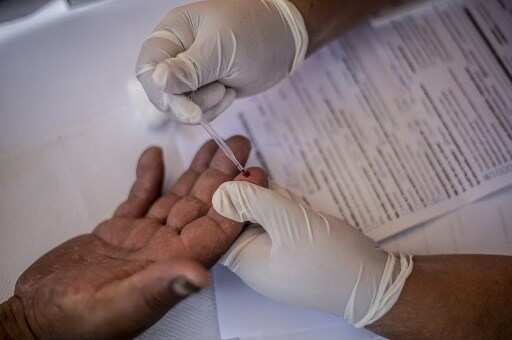 Another patient cured of HIV after undergoing stem cell transplant, claim doctors