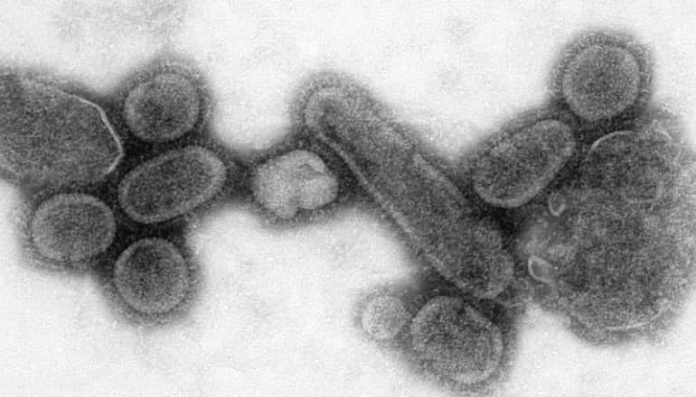 Spanish flu