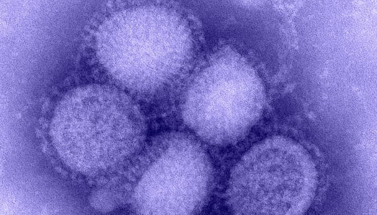 Influenza