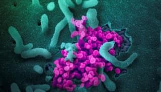 Researchers develop antibodies for neutralising SARS-Cov-2, the virus that causes Covid