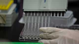 Scientists develop method to reduce coronavirus count in plasma, blood products