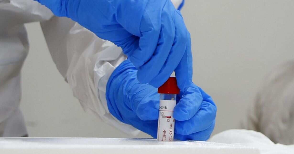 Over 400 confirmed cases