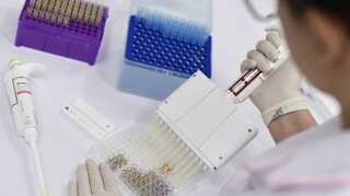 Coronavirus an inevitable consequence of long-term environmental damage: Report