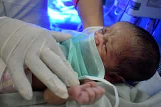 Human 'microevolution' forming more arteries, less wisdom teeth in babies