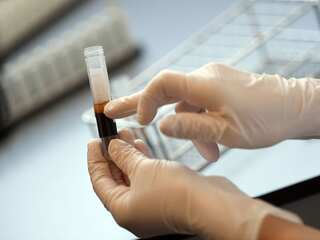 Does plasma therapy help coronavirus patients? This study reveals shocking results