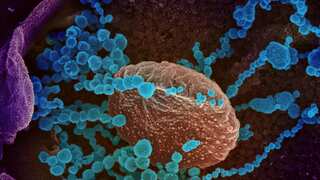 Coronavirus: No significant clinical benefits of remdesivir, claims a new Lancet study