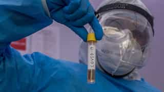 Coronavirus patient recovers after plasma therapy in Pakistan