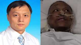 Coronavirus darkens skin and damages liver of Wuhan doctors infected by it