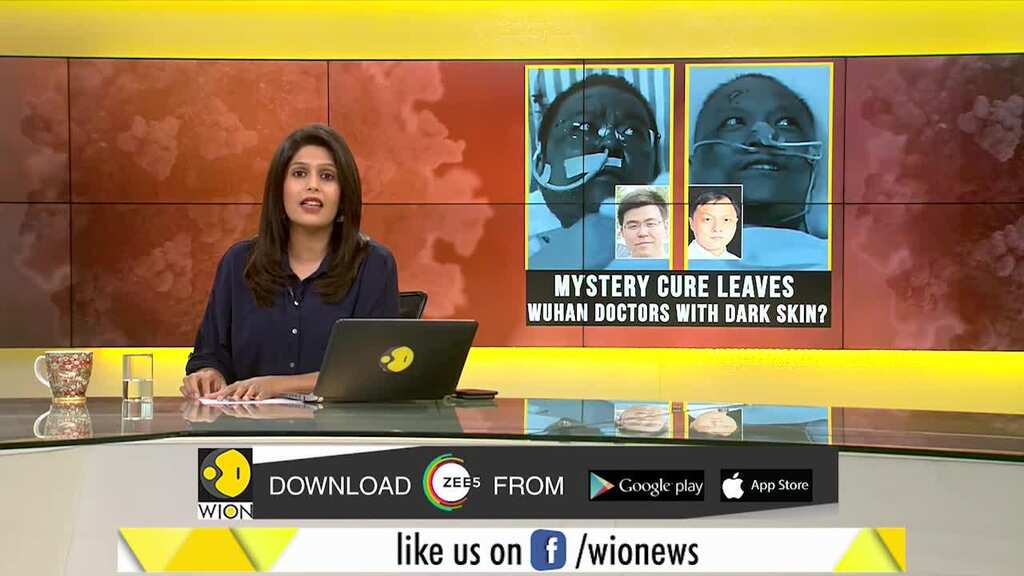 Wuhan: Coronavirus positive doctors' skin goes dark after treatment | Gravitas