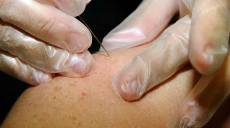 Coronavirus could cause these five skin conditions: Study Coronavirus could cause these five skin conditions: Study