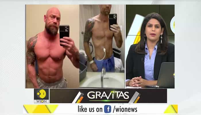 Gravitas: Shocking weight loss from Coronavirus