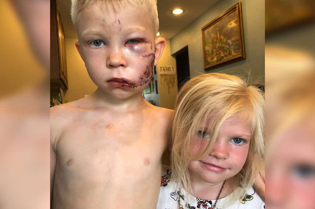 6-year-old boy fights with a dog to save his sister