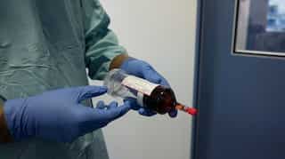 A new blood test can detect cancer four years before symptoms show