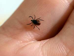 First cases of rare tick-borne disease recorded in UK