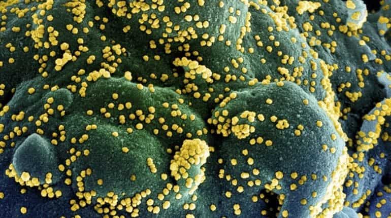United States: Brain-eating amoeba kills six-year-old boy in Texas United States: Brain-eating amoeba kills six-year-old boy in Texas