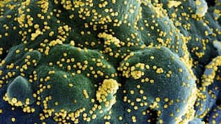 United States: Brain-eating amoeba kills six-year-old boy in Texas