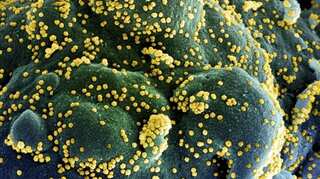 United States: Brain-eating amoeba kills six-year-old boy in Texas