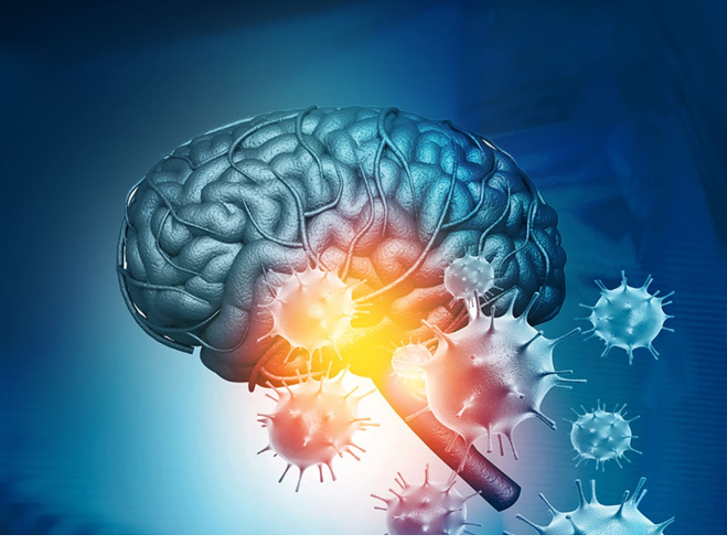 Coronavirus can trigger range of neurological problems