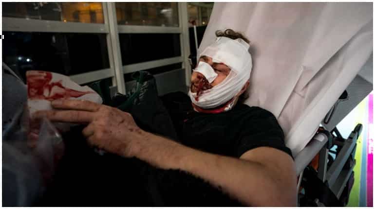 Paris: Wounded photographer says protests brought back Syria memories Paris: Wounded photographer says protests brought back Syria memories