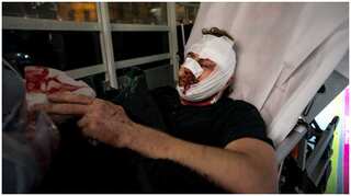 Paris: Wounded photographer says protests brought back Syria memories