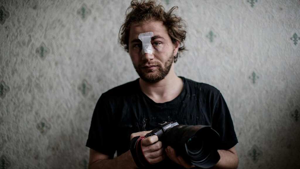 An award-winning Syrian photographer, wounded during protest in Paris
