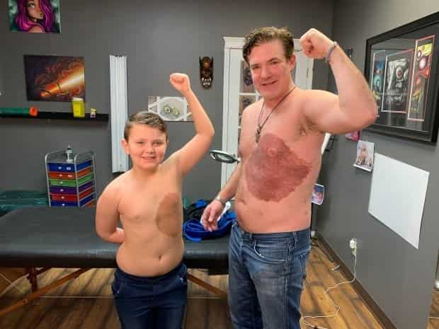 A father in Canada gets tattoo to match son's birthmark