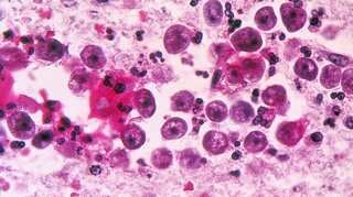 Climate change will shoot up cases of brain-eating amoeba. Here's how