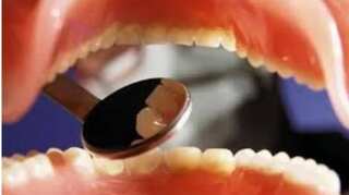 Oral ulcer, teeth cracking may be symptoms of coronavirus: UK professor