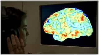 Strange hyperactivation in brain can be early sign of Alzheimer's