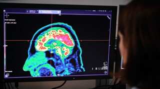 LSD allows brain to trespass anatomical rules, new study finds