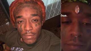 Rapper Lil Uzi Vert gets a diamond implant on his forehead like Marvel's Vision