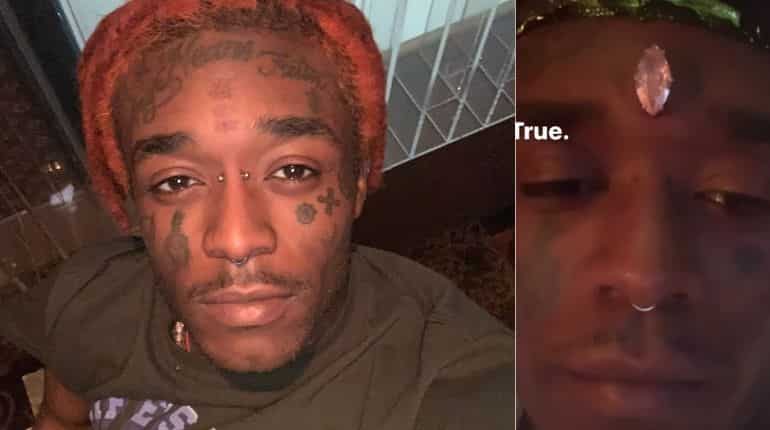 Rapper Lil Uzi Vert gets a diamond implant on his forehead like Marvel's Vision