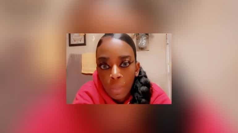 US woman who glued her hair raises $15,000 for treatment