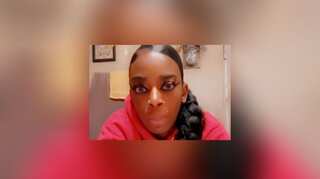 US woman who glued her hair raises $15,000 for treatment