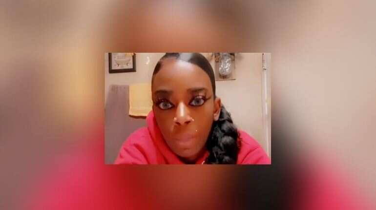 US woman who glued her hair raises $15,000 for treatment