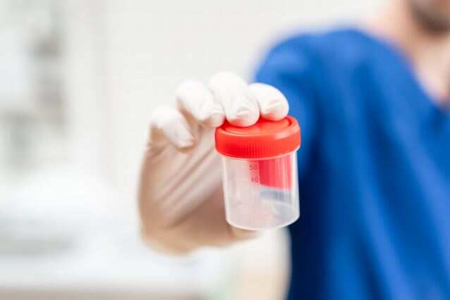 UK scientists develop urine test to detect womb cancer UK scientists develop urine test to detect womb cancer