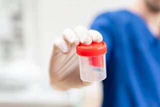 UK scientists develop urine test to detect womb cancer