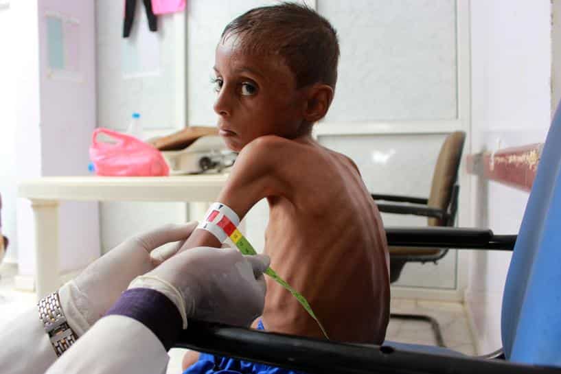 Over 2 million Yemeni children may starve in 2021, UN says