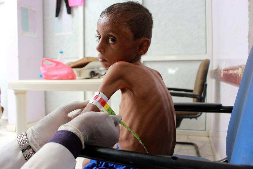 Over 2 million Yemeni children may starve in 2021, UN says