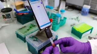 French researchers develop COVID test that gives results like USB device