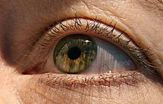 How changes in texture of retina may reveal signs of Alzheimer's disease