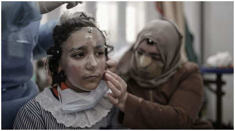 8-year-old girl in Gaza wears 3D printed mask to heal severe burns 8-year-old girl in Gaza wears 3D printed mask to heal severe burns