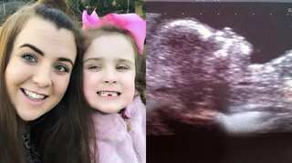 'Miracle baby': Woman becomes pregnant, despite being virgin