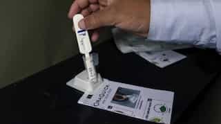 Argentina: Second person known to be naturally cured of HIV raises hopes for millions