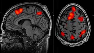 Scientists tracked a thought as it moved through the brain. What did they find?