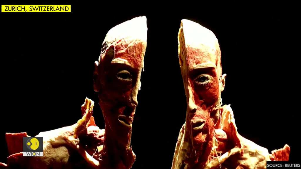 Donate a body for art and science? Zurich exhibition gives food for thought