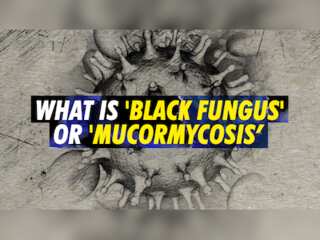 Black Fungus or Mucormycosis: Deadly fungal infection making some COVID-19 patients blind in India