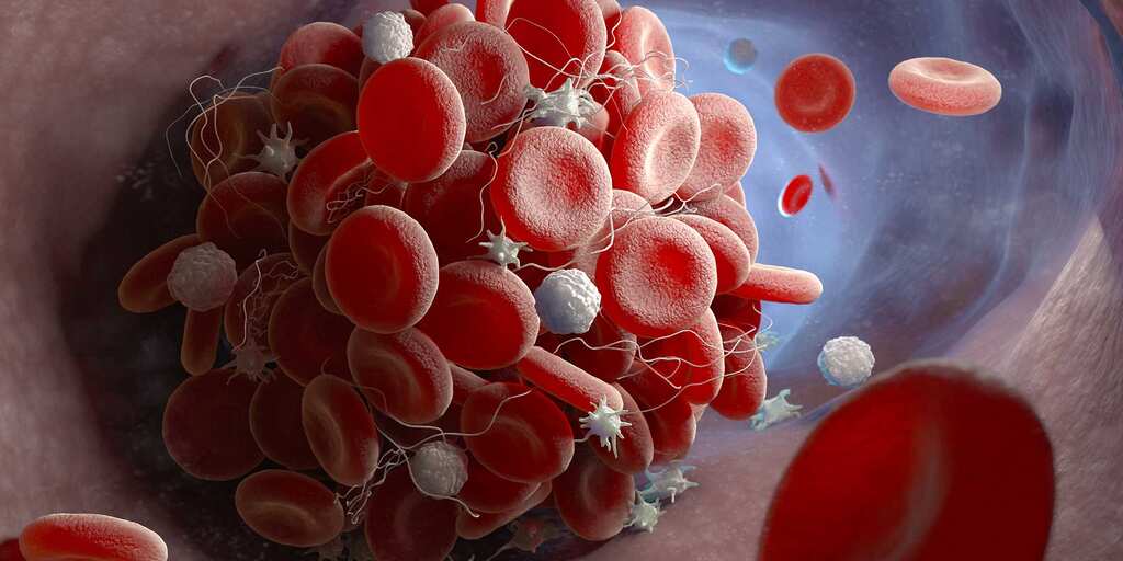 Vaccines may be redesigned to avoid blood clots, German scientists claim