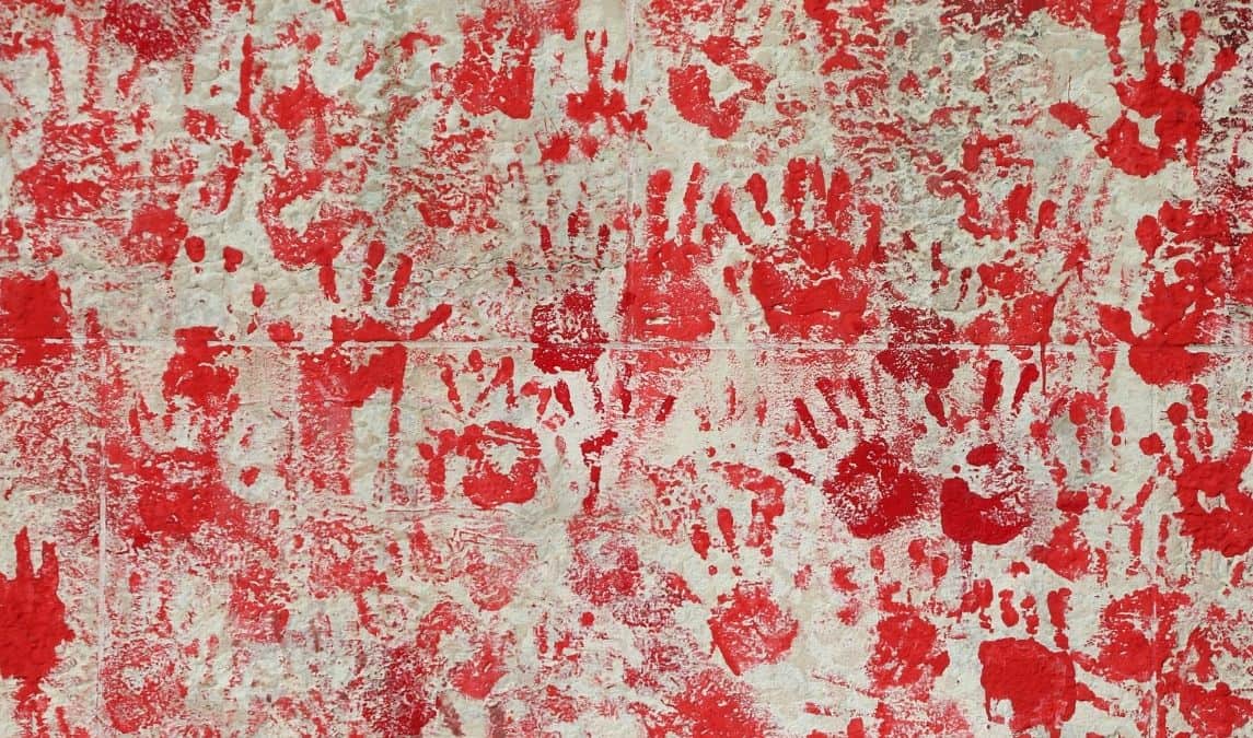 Blood stained hands