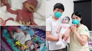 'Smallest baby at birth' comes home after 13 months in the hospital